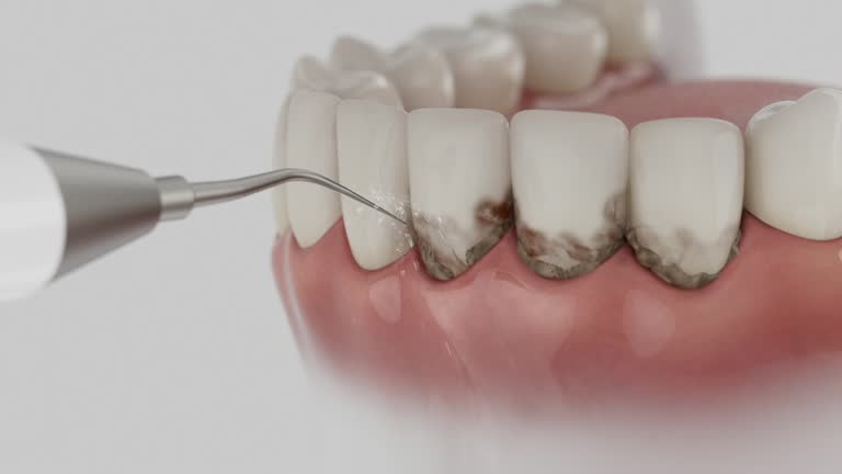 Trusted Dental Implants service in Martin, SD - Dentist Open Now